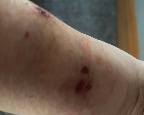 Injury caused by a dog during a scan